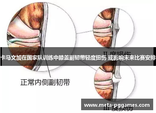 卡马文加在国家队训练中膝盖副韧带轻度扭伤 或影响未来比赛安排